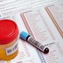 When Are Truck Drivers Subject to Drug Tests?